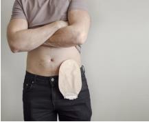 Ostomizados